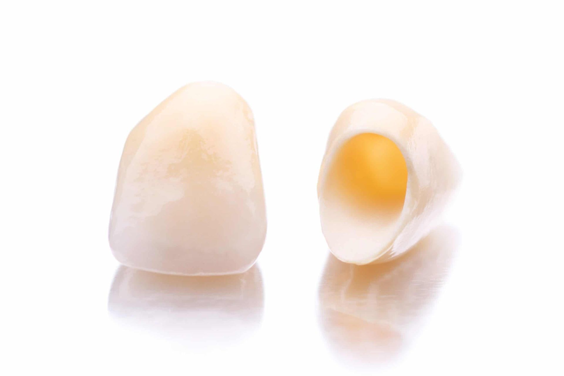 A pair of dental crowns on a white surface.