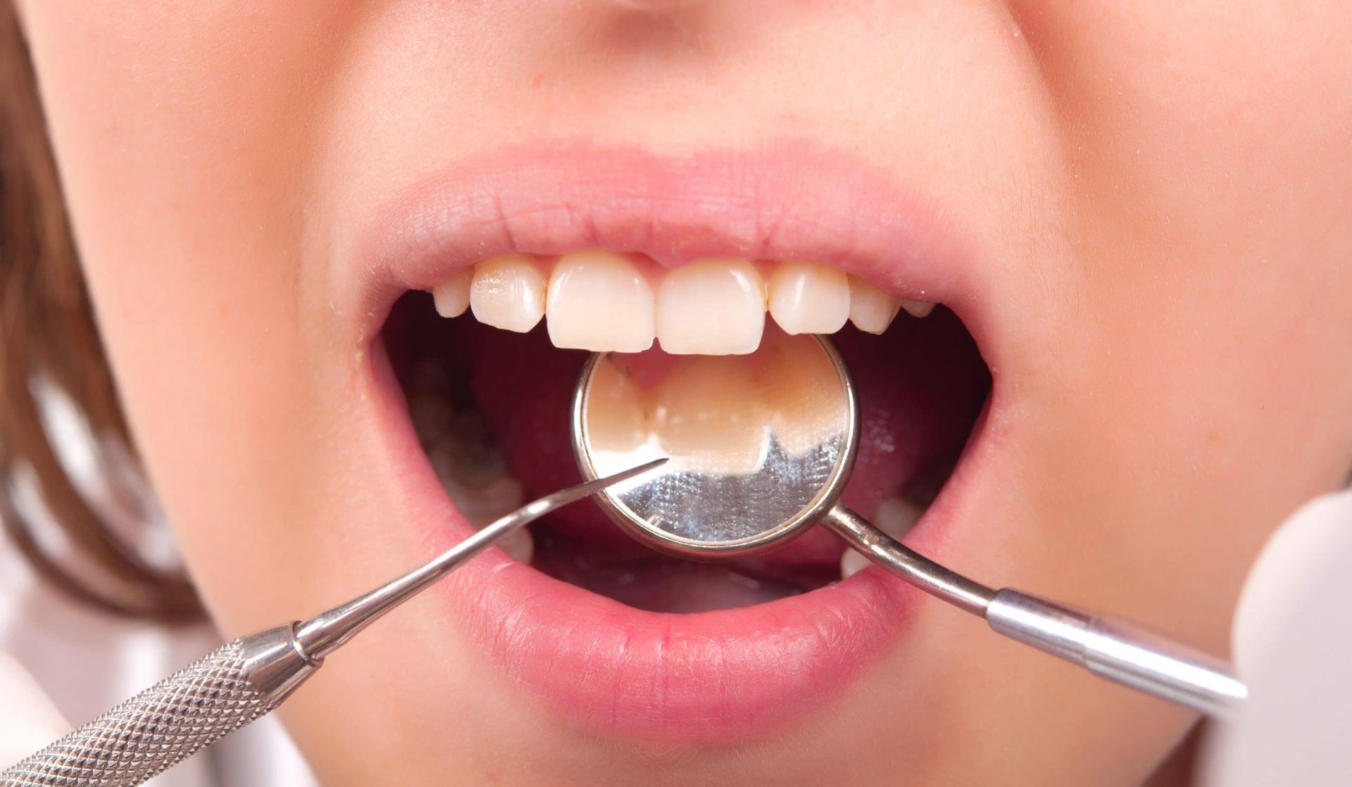 A woman is getting her teeth examined by a dentist.