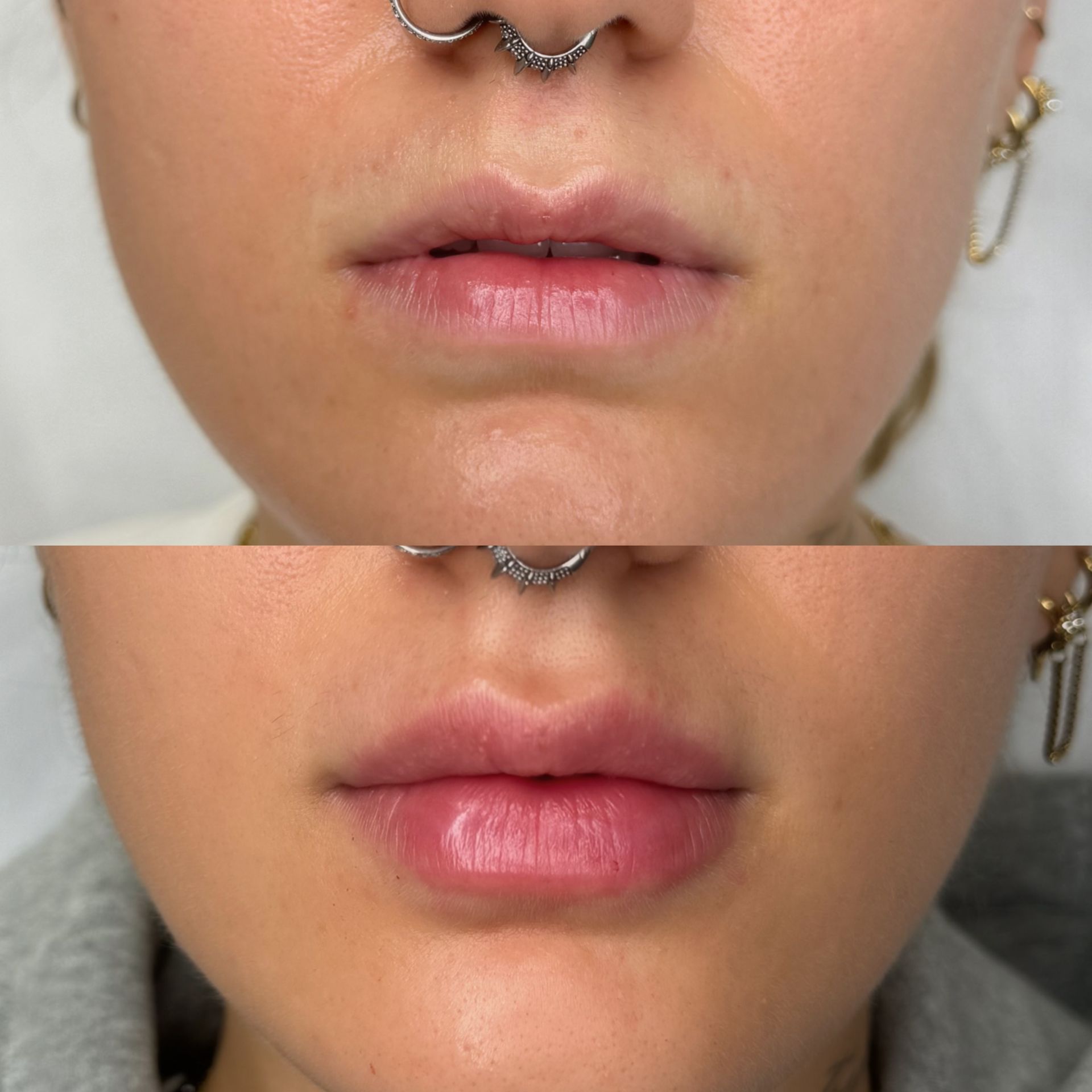 medycyna estetyczna tarnów