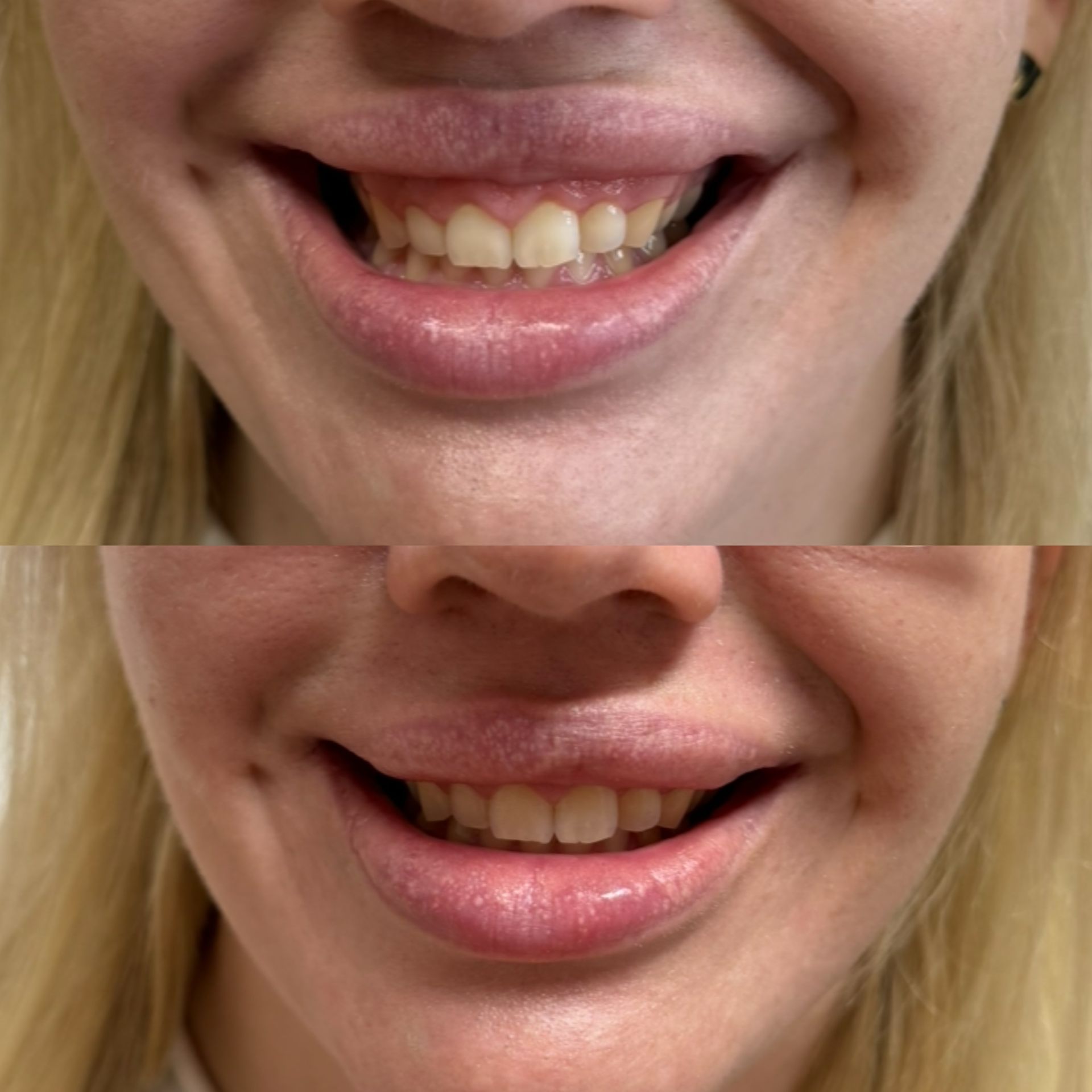 medycyna estetyczna tarnów