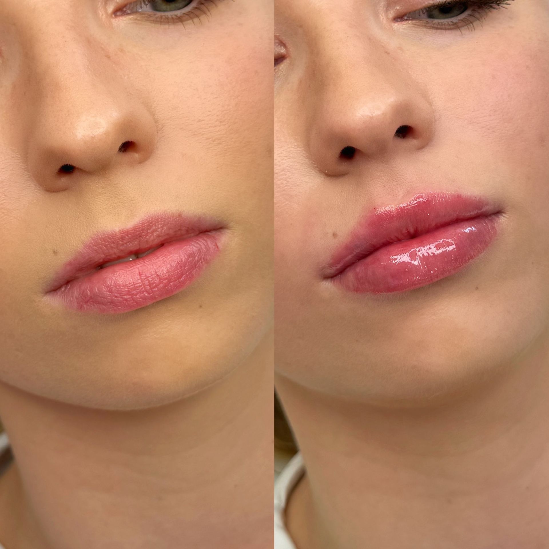 medycyna estetyczna tarnów