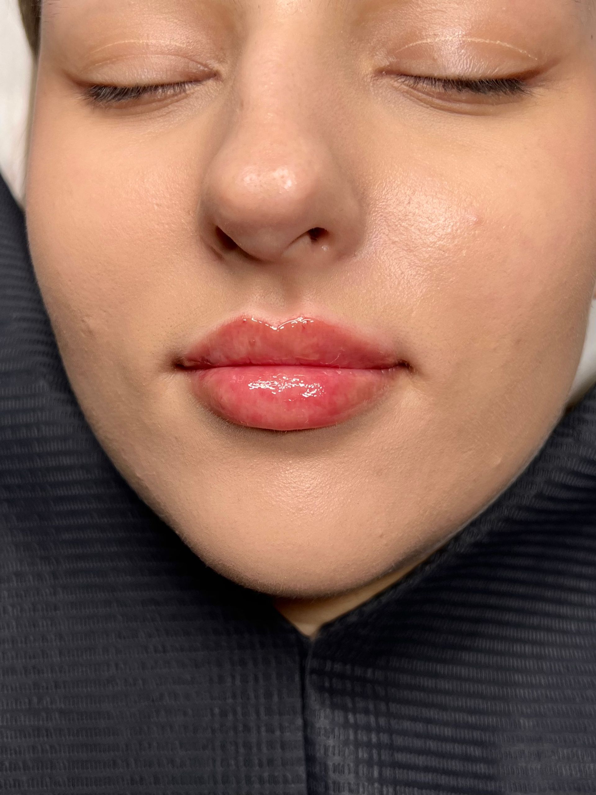 medycyna estetyczna tarnów