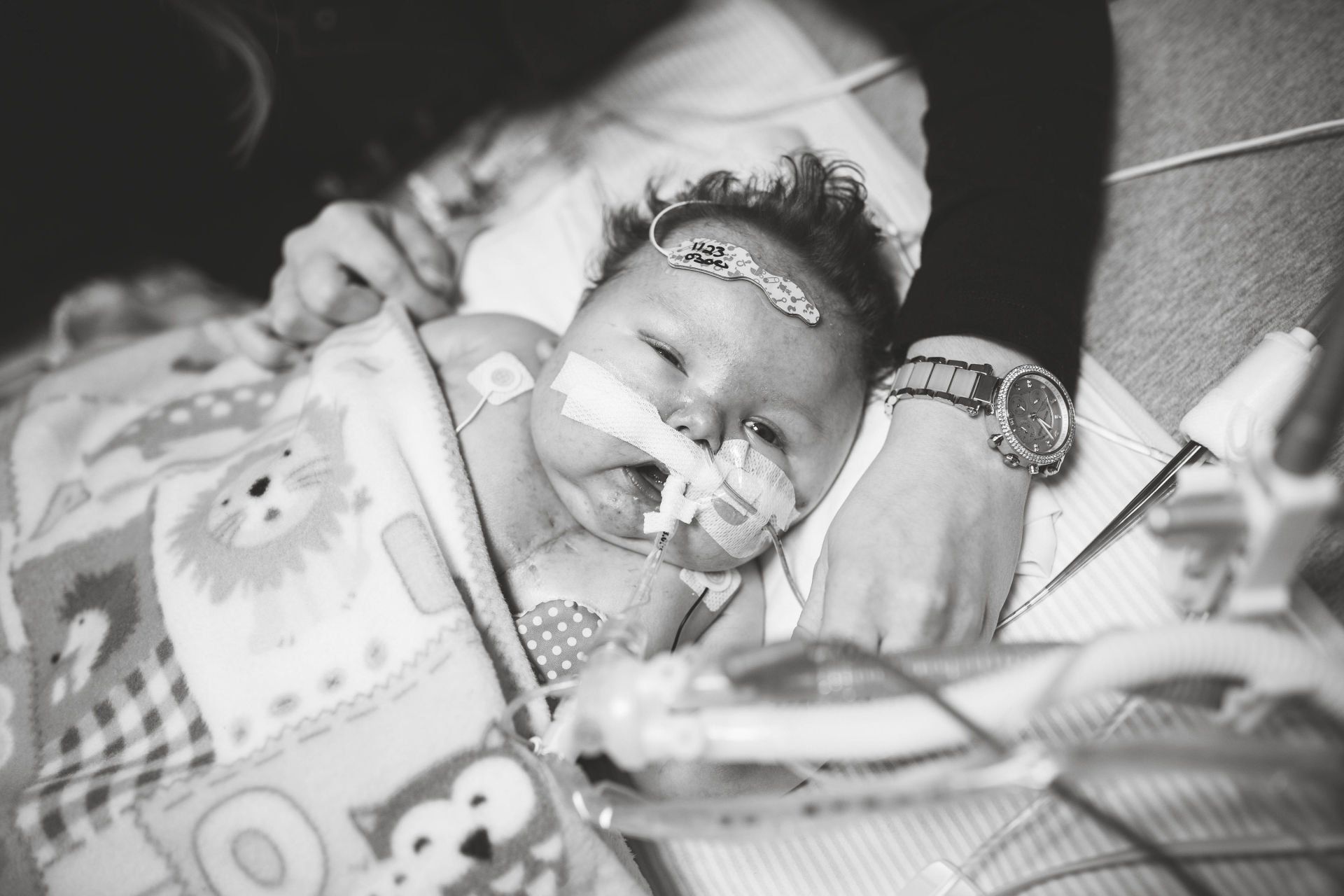 newborn chd baby world of broken hearts