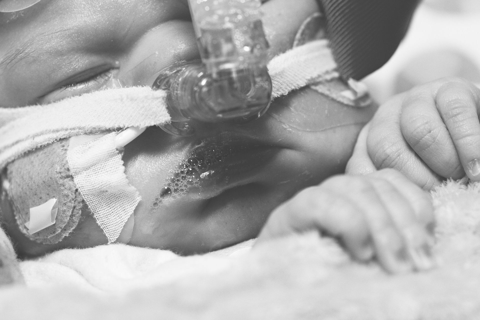 congenital heart disease