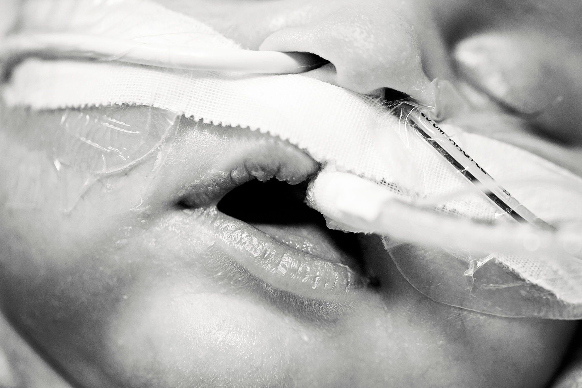 world of broken hearts congenital heart awareness