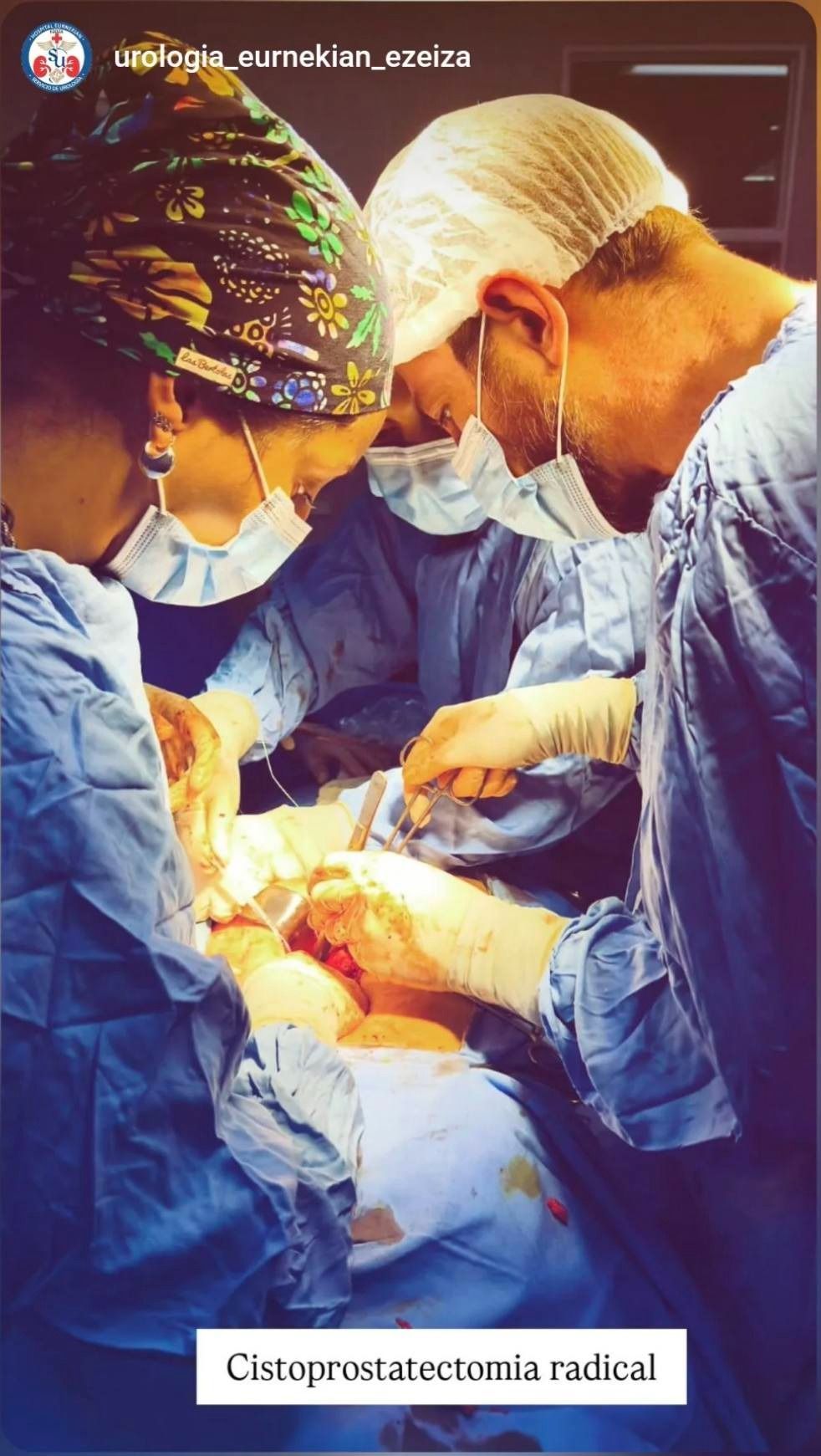 Cirujanos en quirófano, realizando una cistoprostatectomía radical.