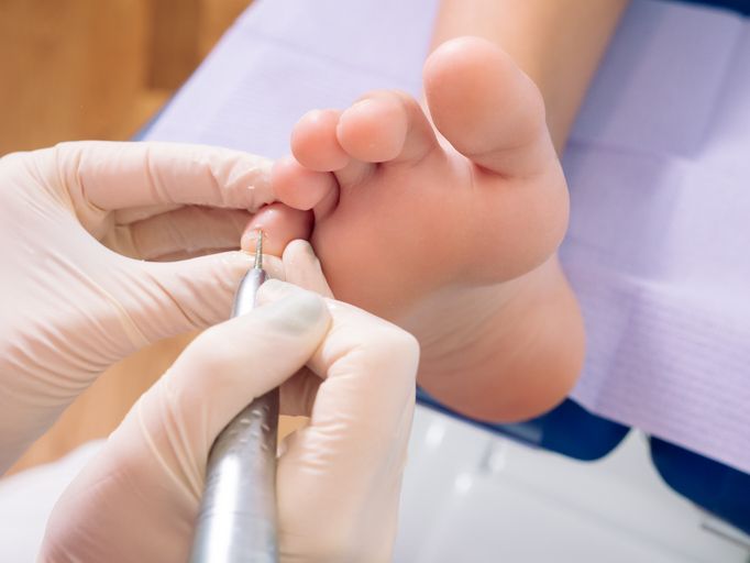 General Podiatry | Ivanhoe, VIC | Ivanhoe Podiatry Centre
