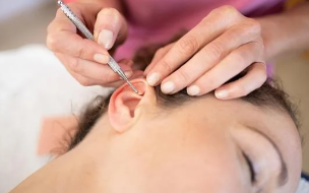 réfexologie auriculaire
