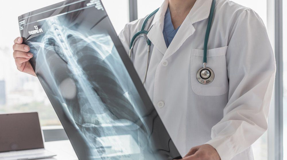 Internal Medicine — Doctor With Radiological Chest X-ray In Big Spring, TX
