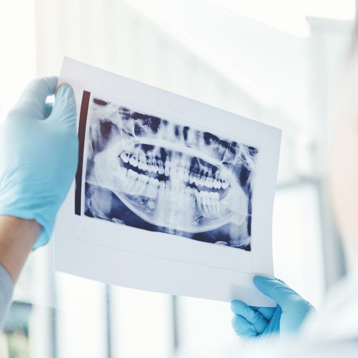 Digital x-ray result — Ashland and Ruther Glen, VA — Ashland Family Dentistry