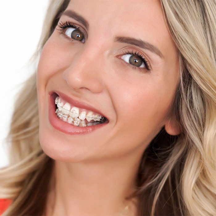 Woman with braces on her teeth — Ashland and Ruther Glen, VA — Ashland Family Dentistry