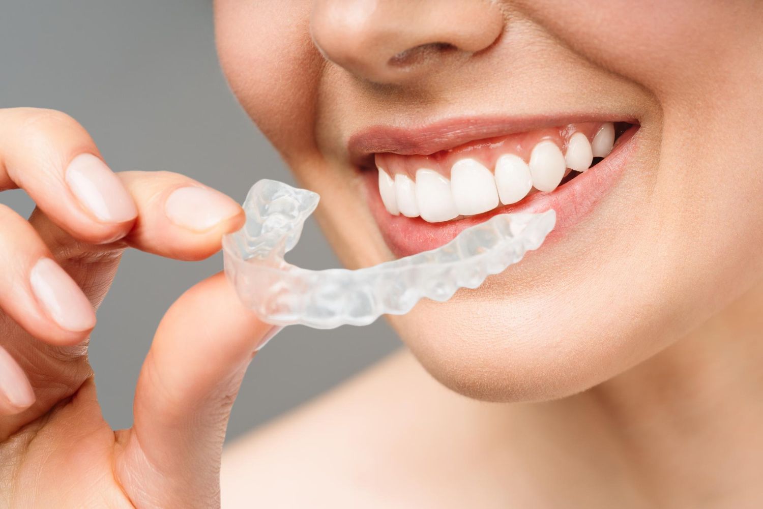 invisalign