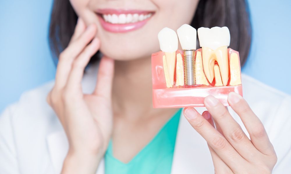 Dental Implants A Comprehensive Solution to Tooth Loss