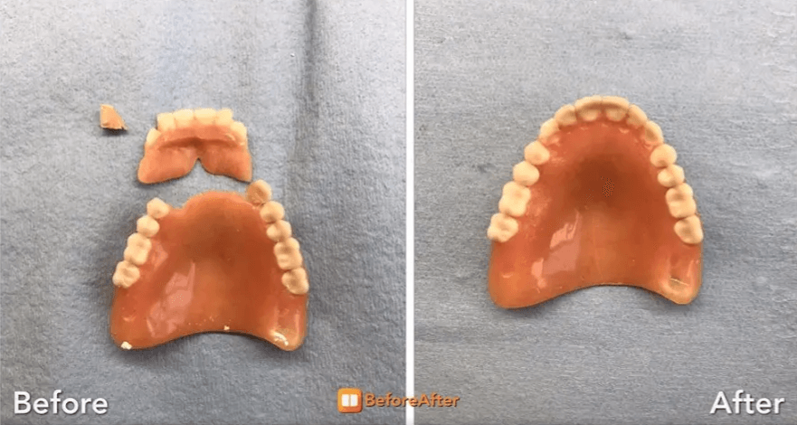 Broken denture repaired before and after