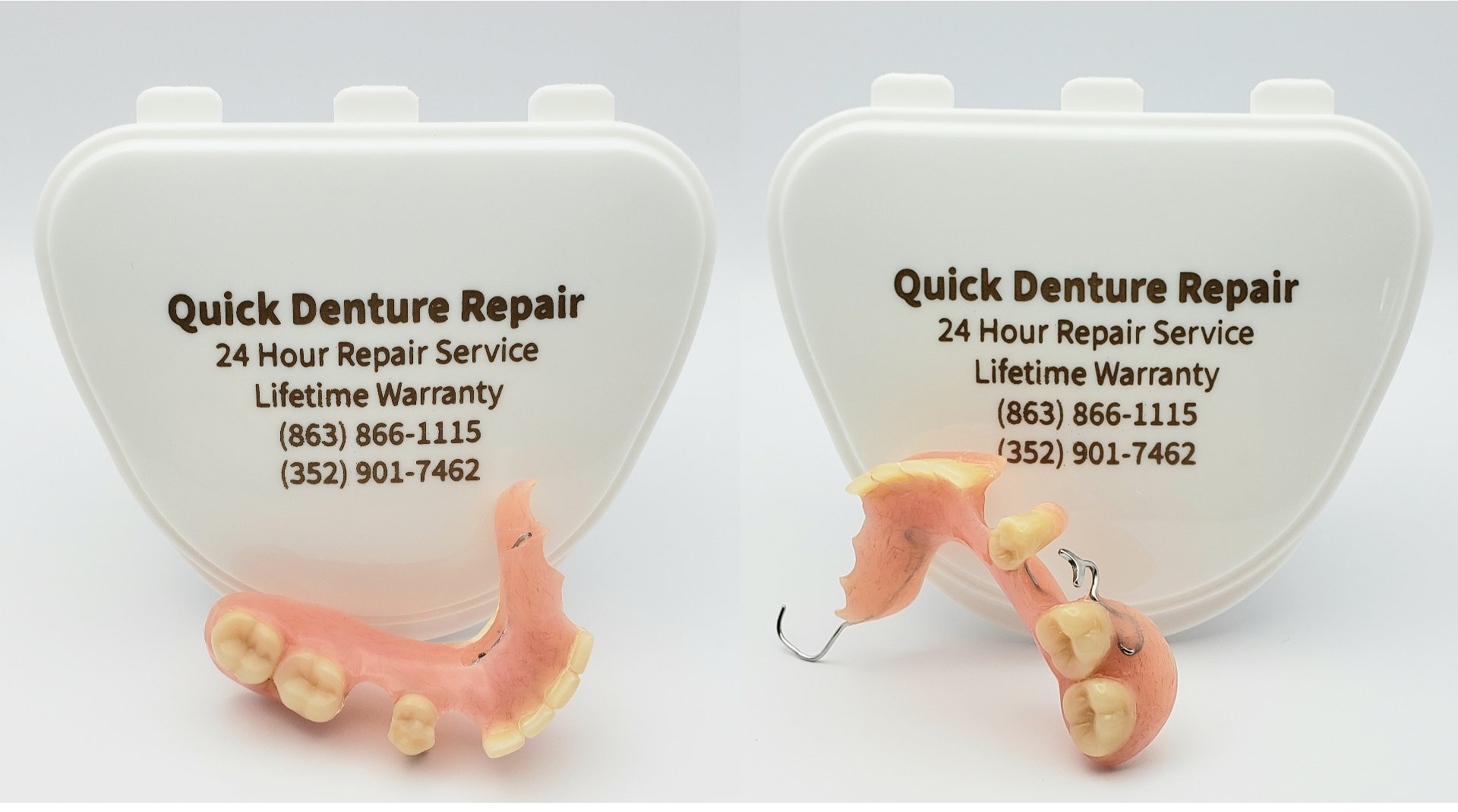 Broken clasp on partial denture repaired before and after