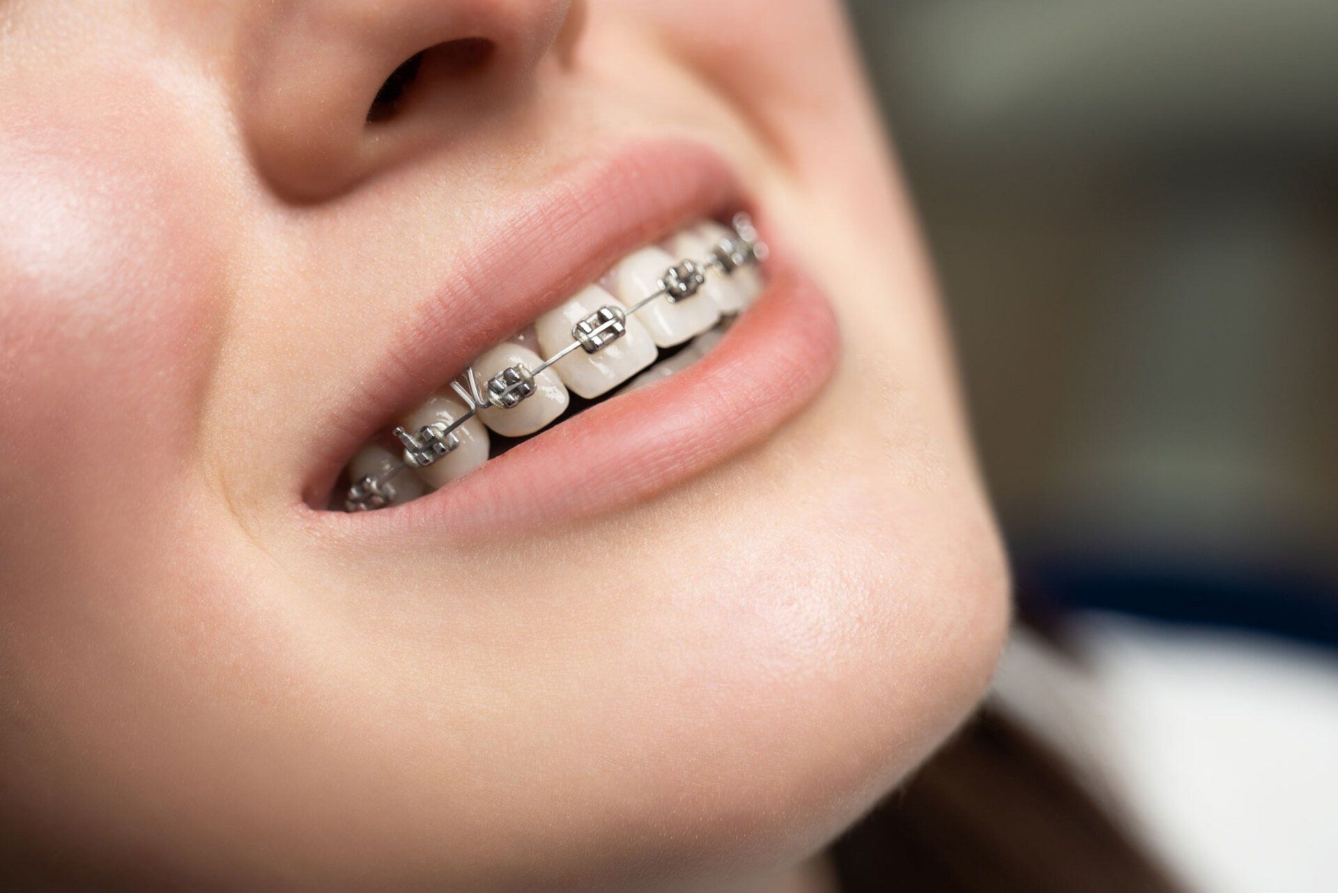 Orthodontics — Rochester Hills, MI — The Elite Smile Center