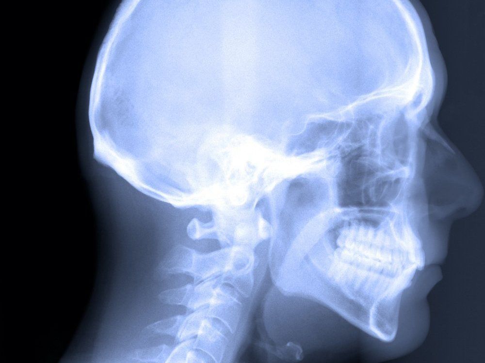 skull and jaw x-ray