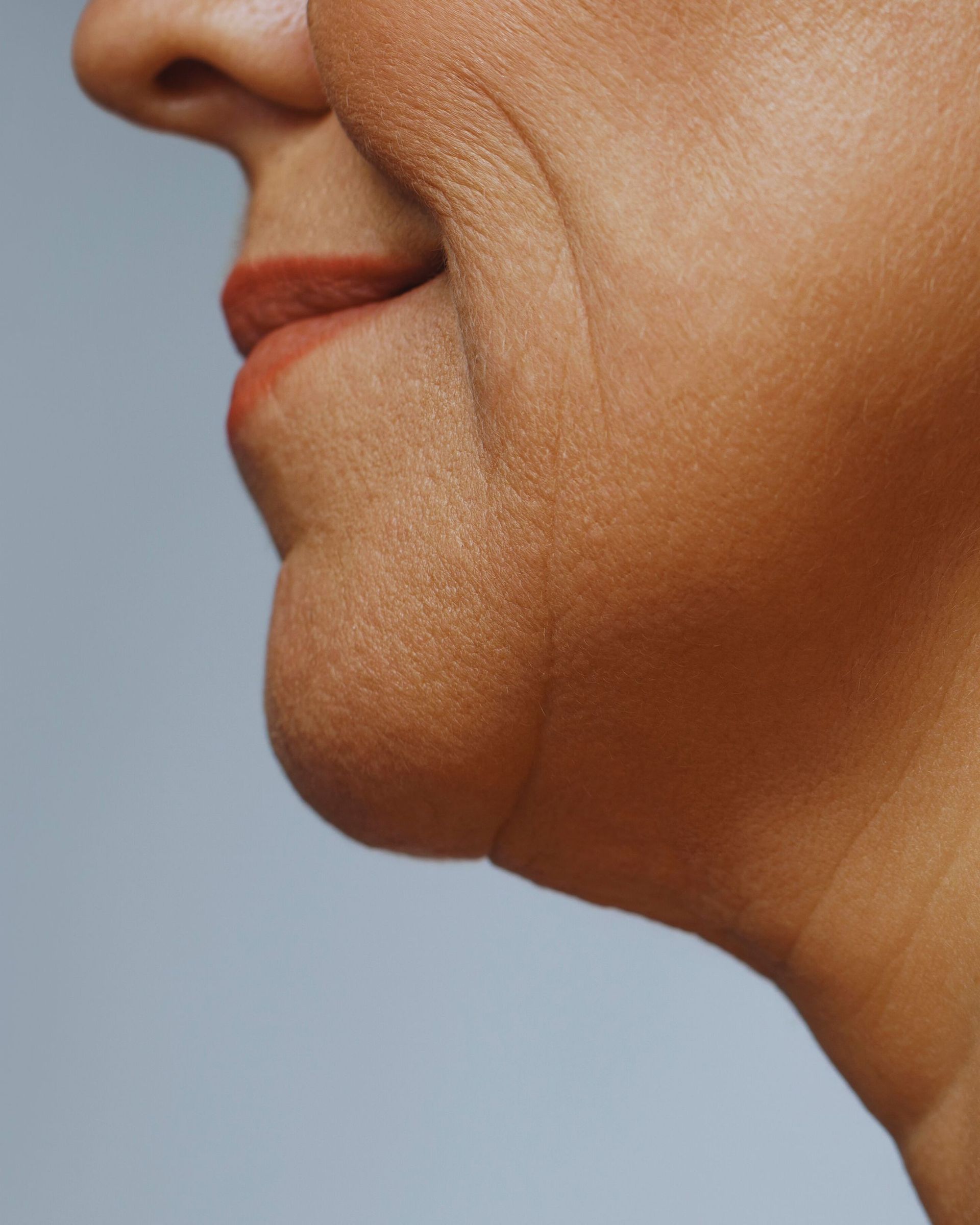 Side view of a person's neck and chin, showing wrinkles and a double chin against a gray background.