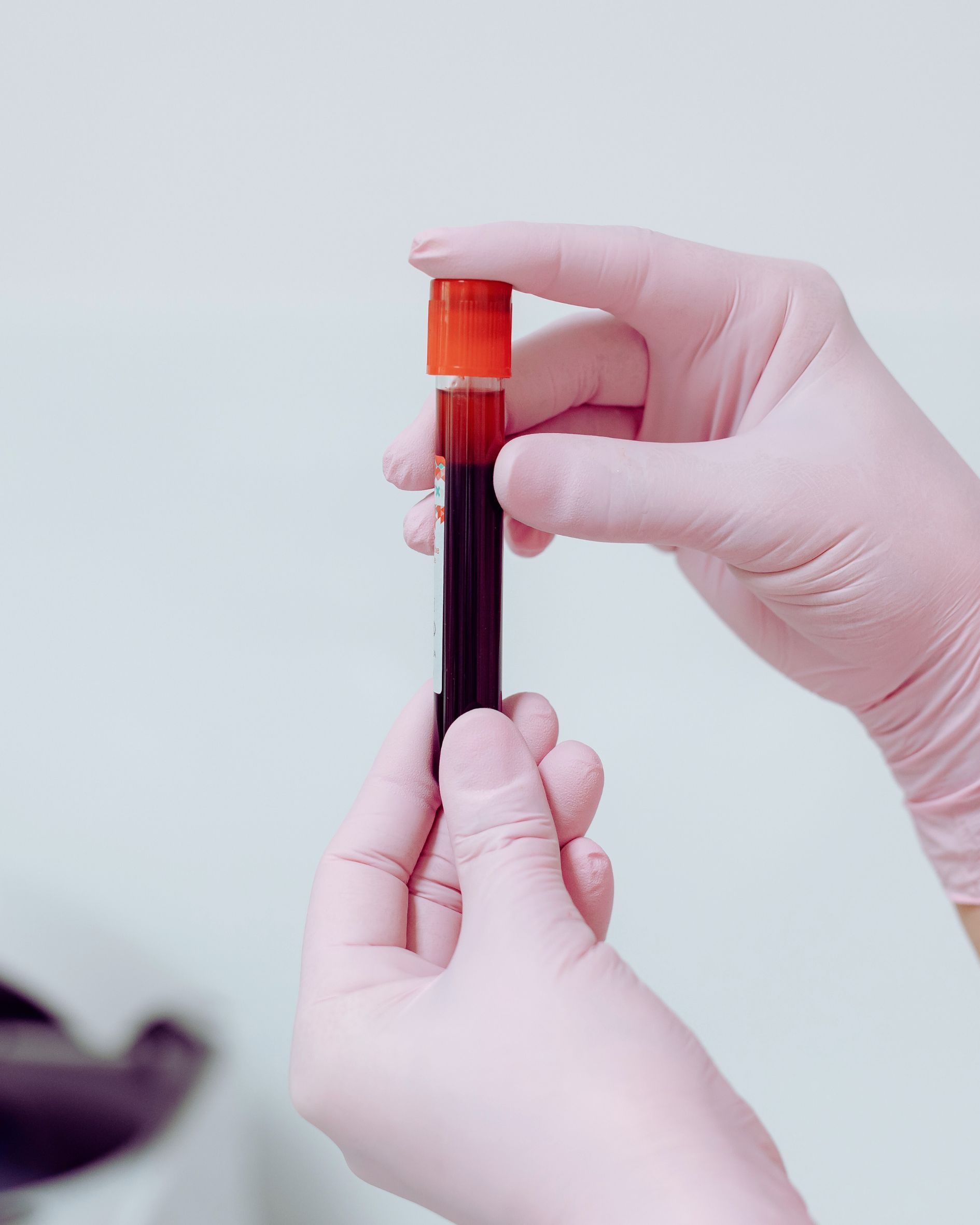 Hands in pink gloves holding a blood sample tube with a red cap against a light background.