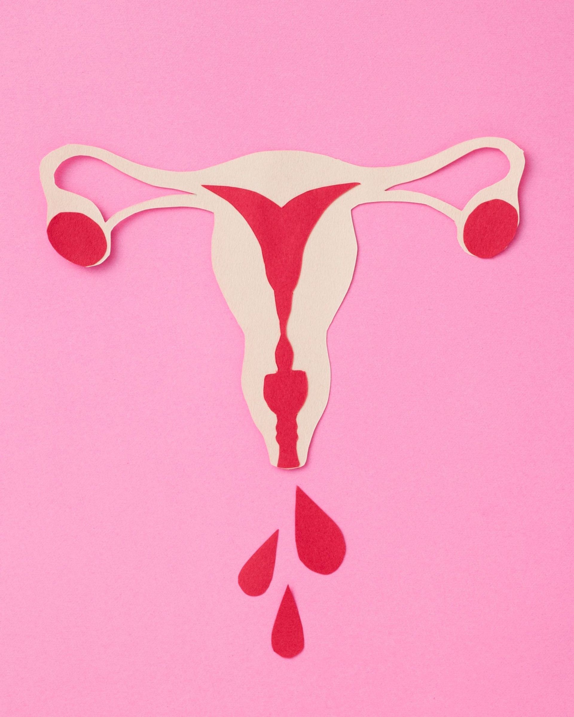 Diagram of a uterus, fallopian tubes, and ovaries with red blood-like illustration; on a pink background.