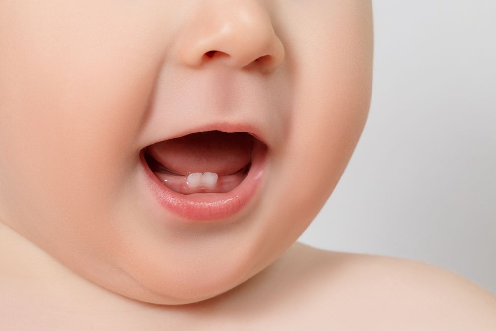 Baby Teeth — Mount Waverley, VIC — Mount Waverley Dental