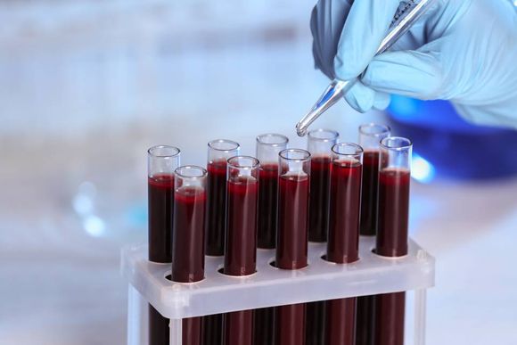 blocco di provette con campioni di sangue