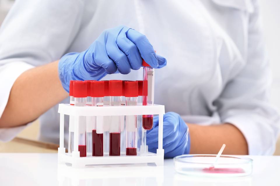 tecnico di laboratorio con campioni sangue