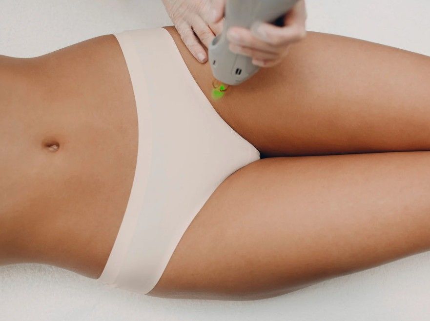 Laser Hair Removal Coventry providing bikini laser hair removal in Coventry