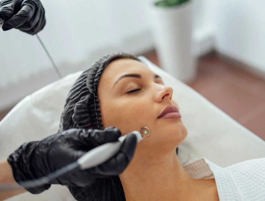 Laser Hair Removal Coventry provising laser acne scar removal treatment in Coventry clinic
