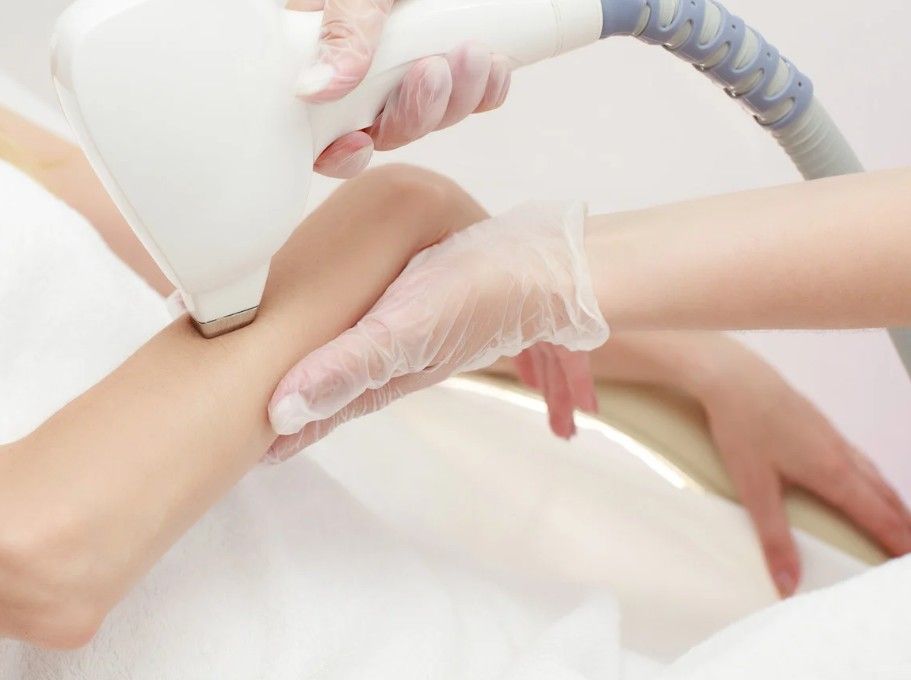 Laser Hair Removal Coventry providing laser hair removal on arms as paetr of a full body laser hair removal procedure