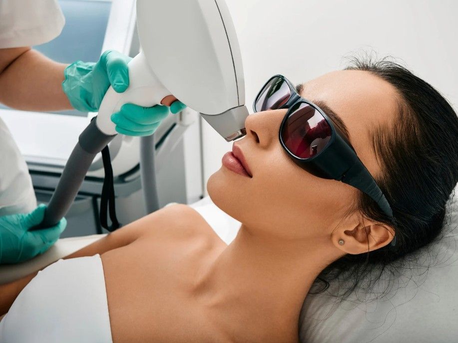 using the laser to remove peach fuzz fine facial hair from a womens upper lip from Bannerbrook Park