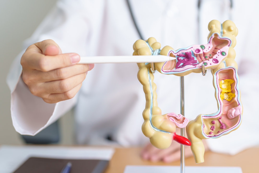 doctor pointing to intestine diagram