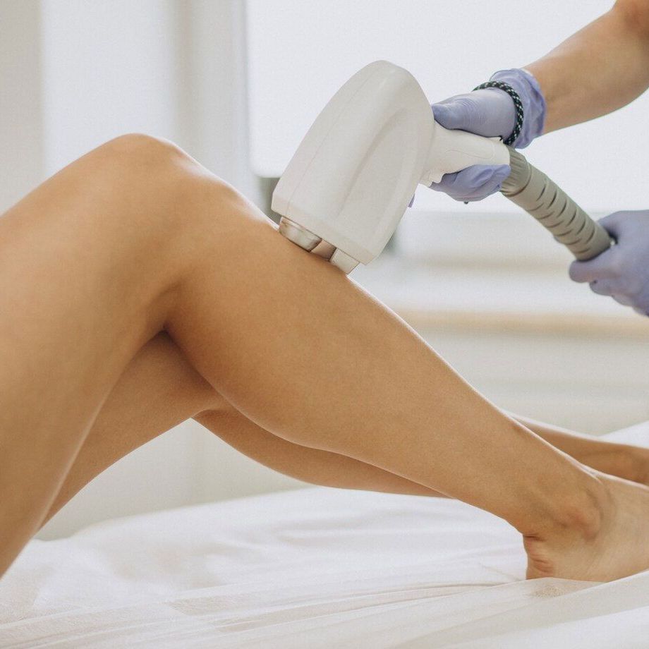 Eine Frau lässt sich an den Beinen eine Laser-Haarentfernung durchführen.