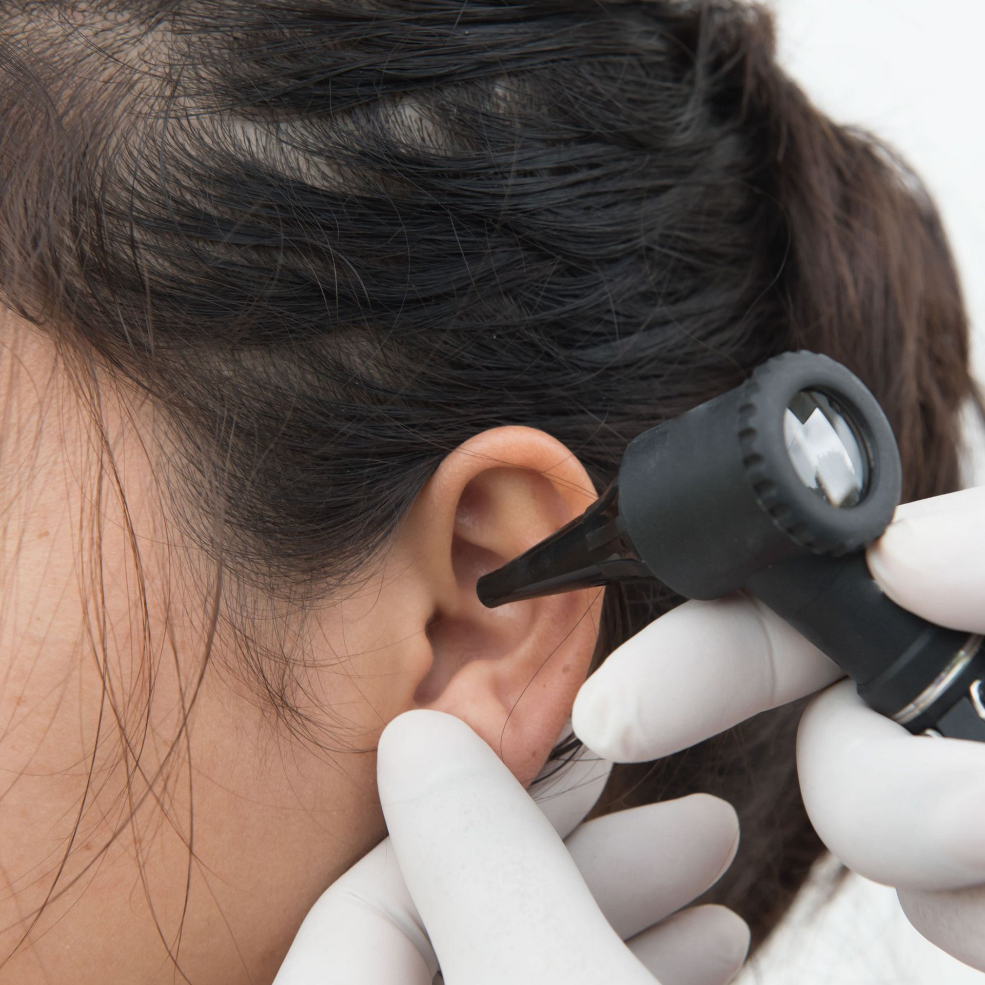 Patient having the ear examined before wax removal at Ashworths Clinic Ashford.