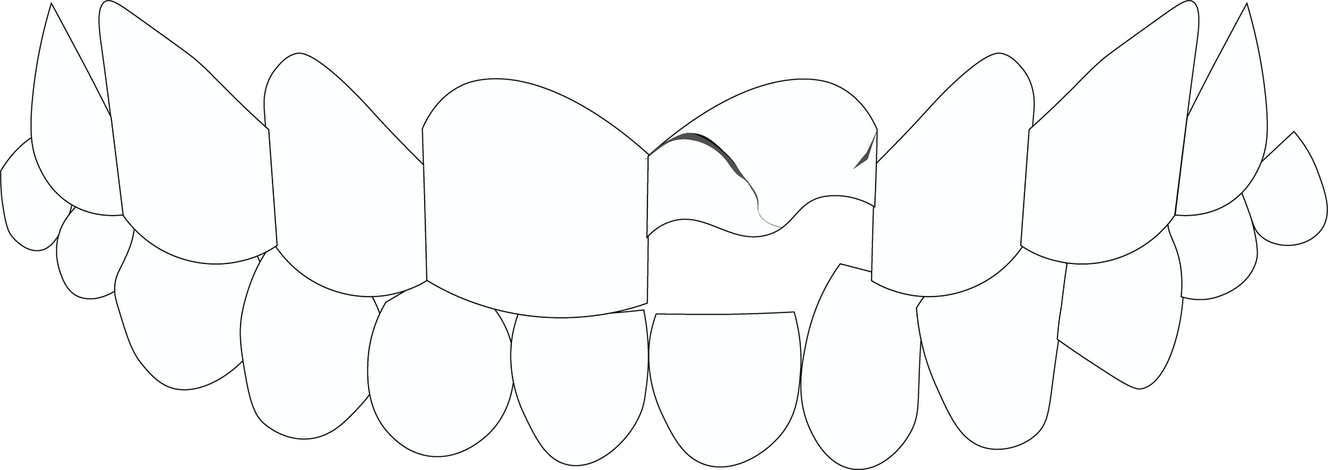 Dental Trauma