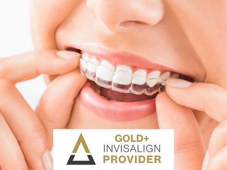 Invisalign