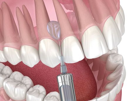 Oral Surgery