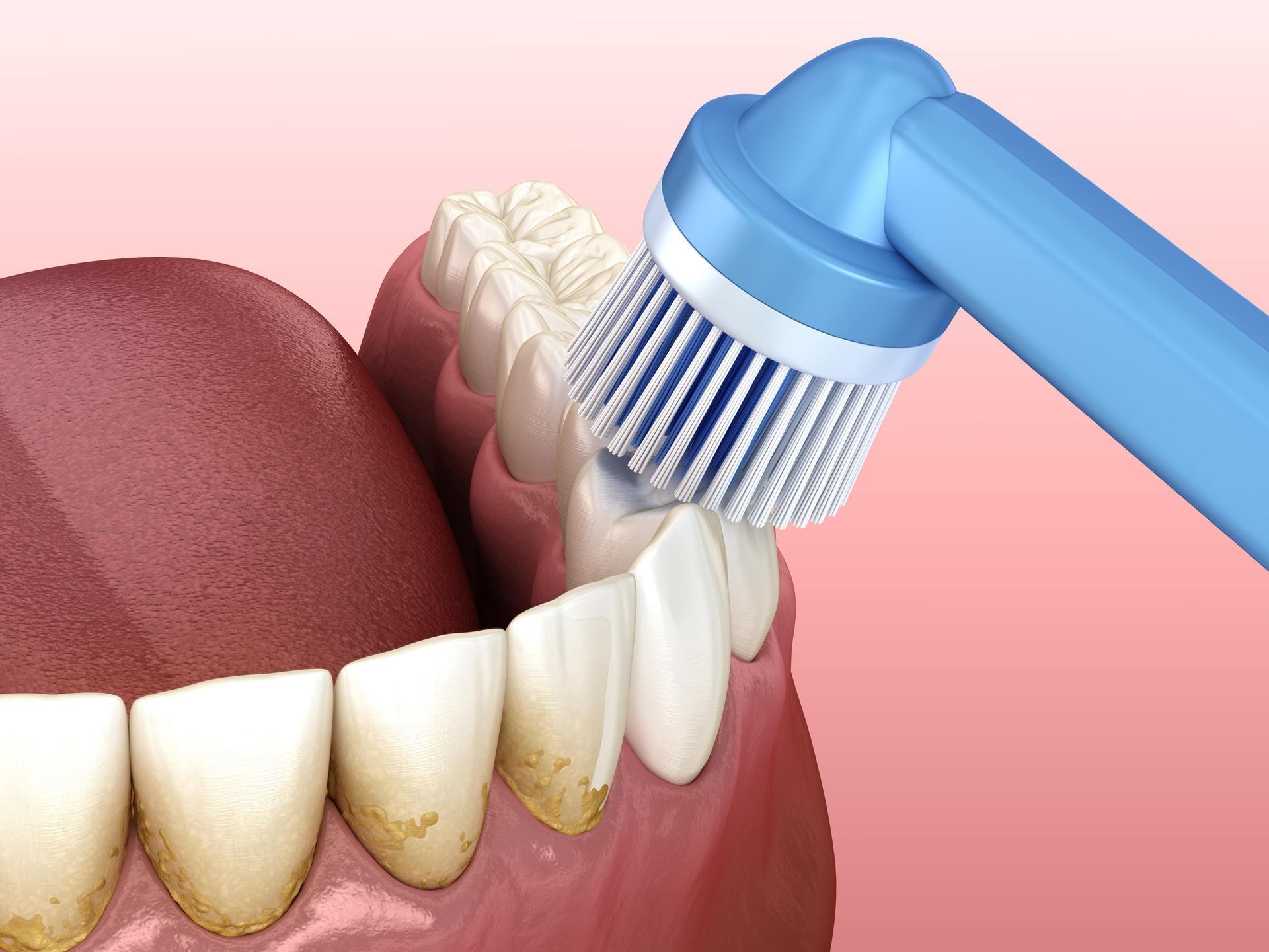 Preventative Dentistry