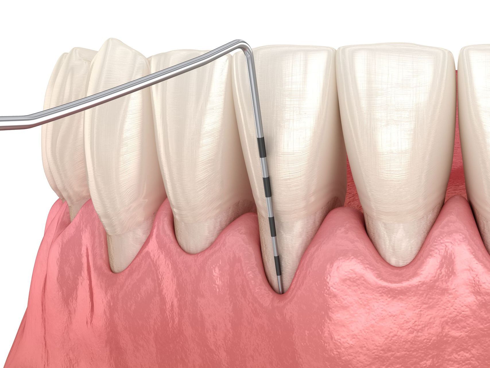 Periodontics