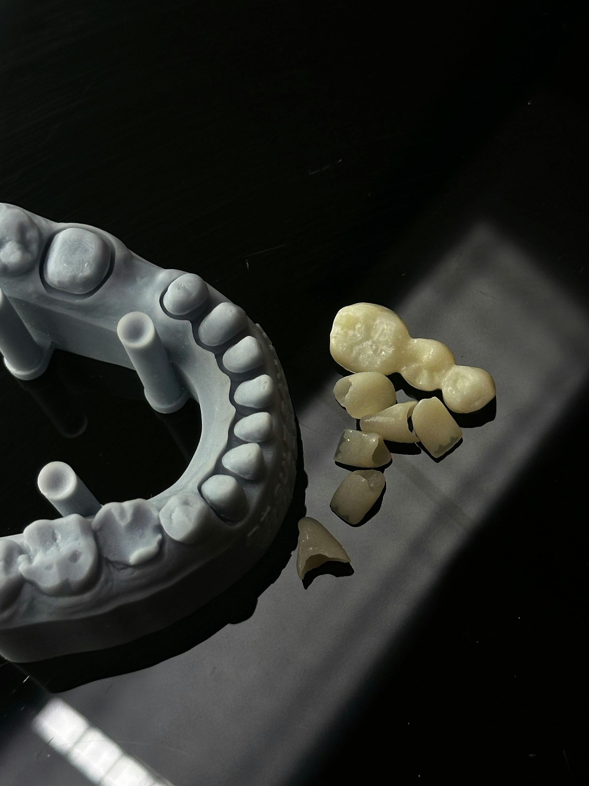 Dental models and fragments; a blue-gray mold of teeth and yellowish-brown tooth pieces.