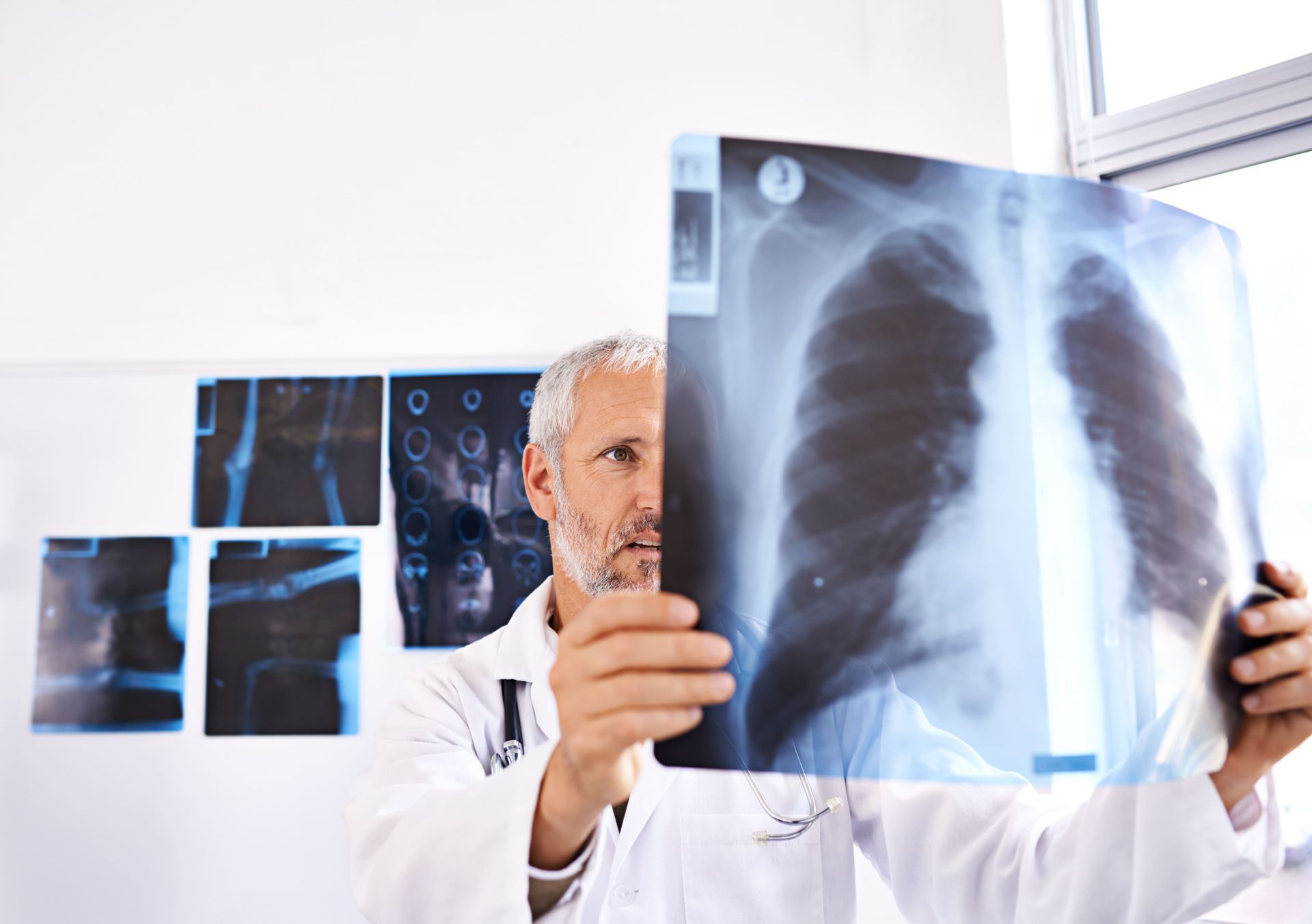 pneumonia de hipersensibilidade