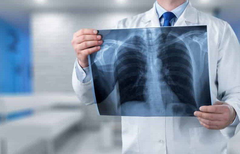 diagnóstico-fibrose-pulmonar