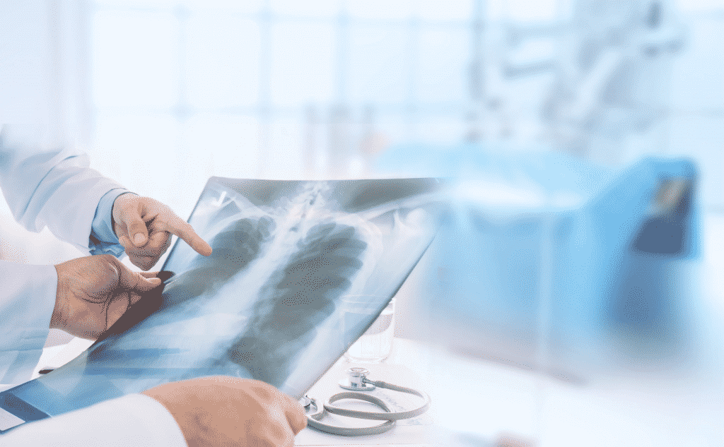 Um médico está examinando uma radiografia dos pulmões de um paciente.