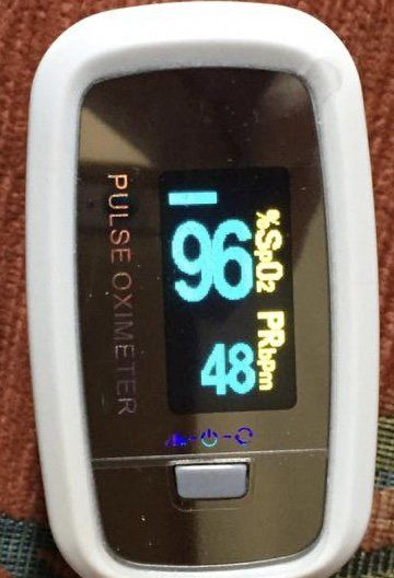 Oxímetro de pulso. Note a leitura da oxigenação (%SpO2) e frequência cardíaca (PRbpm)
