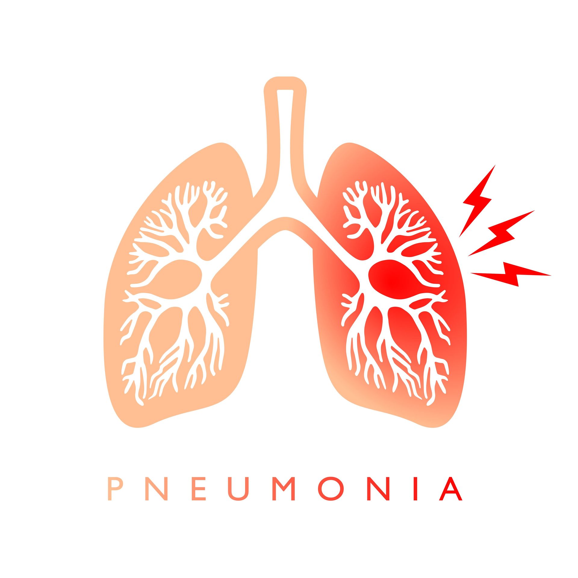 tipos de pneumonia