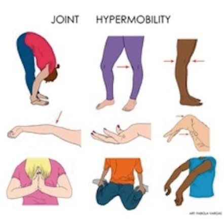 A poster showing different joint hypermobility exercises