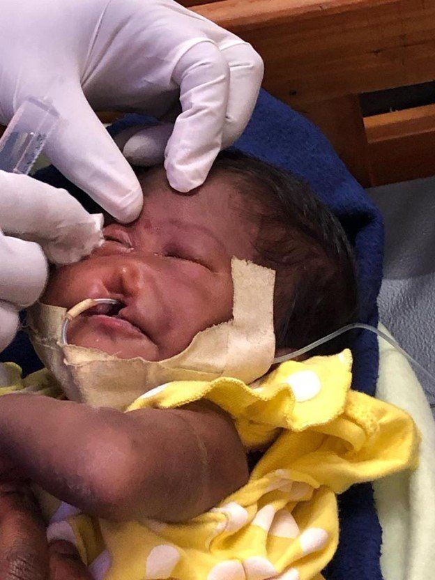 Emergency Surgery — Portland, OR — My Window Man