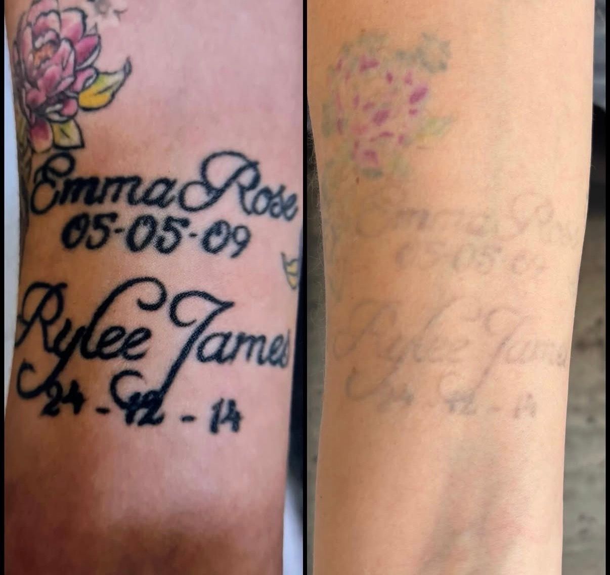 Side-by-side forearm tattoo before and after: faded black script with purple flowers and dates on skin — Laserpro Tattoo Removal in Shellharbour, NSW