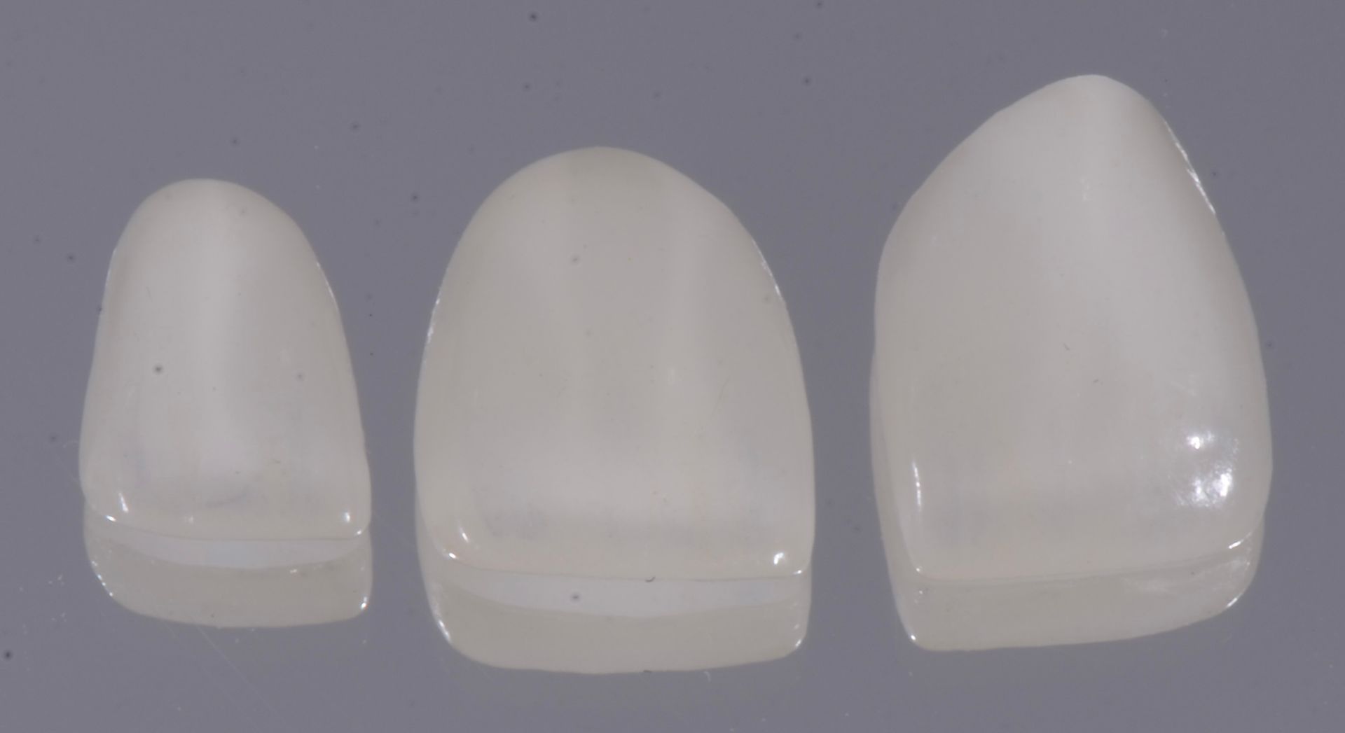Un primo piano di tre denti bianchi su uno sfondo viola.