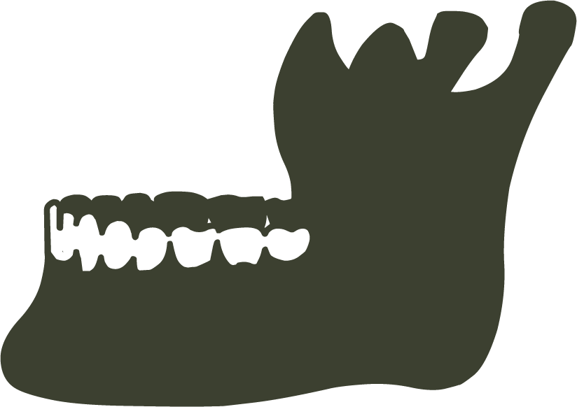 La sagoma della bocca di una persona con denti e corona.